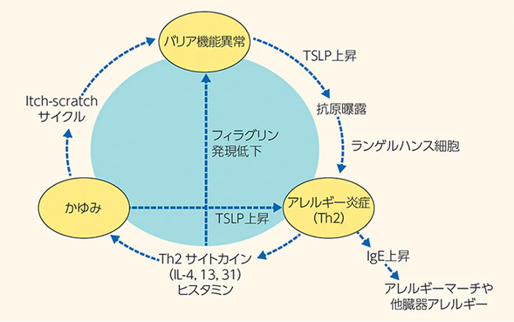 アトピー性皮膚炎の病態 itch-scratch-cycle と 三位一体 理論<