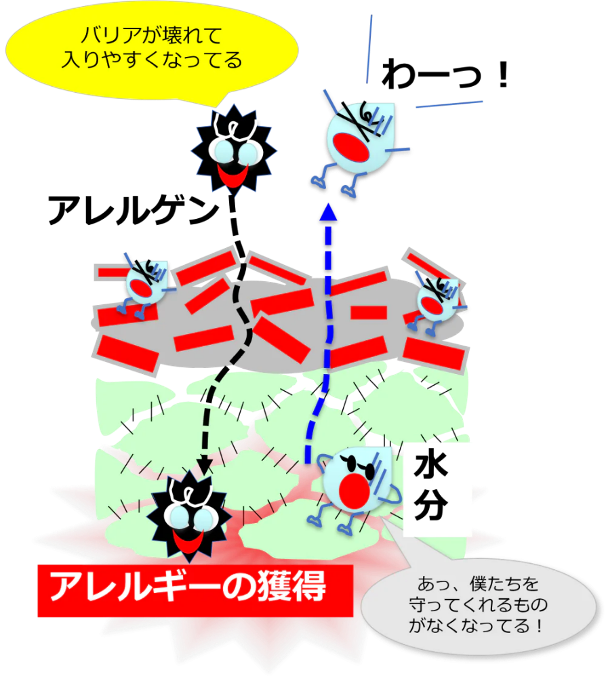 バリア機能の低下した皮膚（乾燥肌）